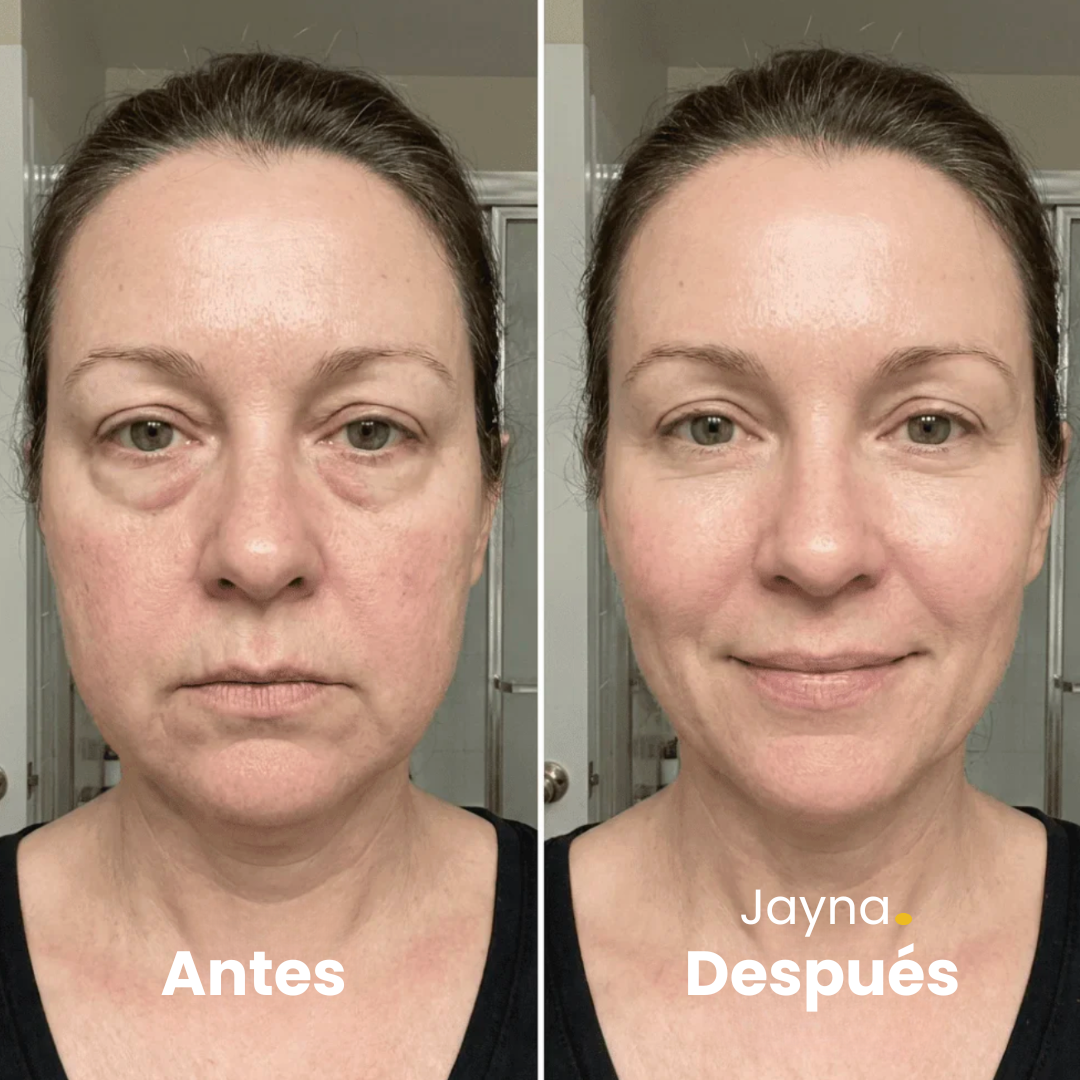 CepiLymph™ – Cepillo de Drenaje Linfático Facial