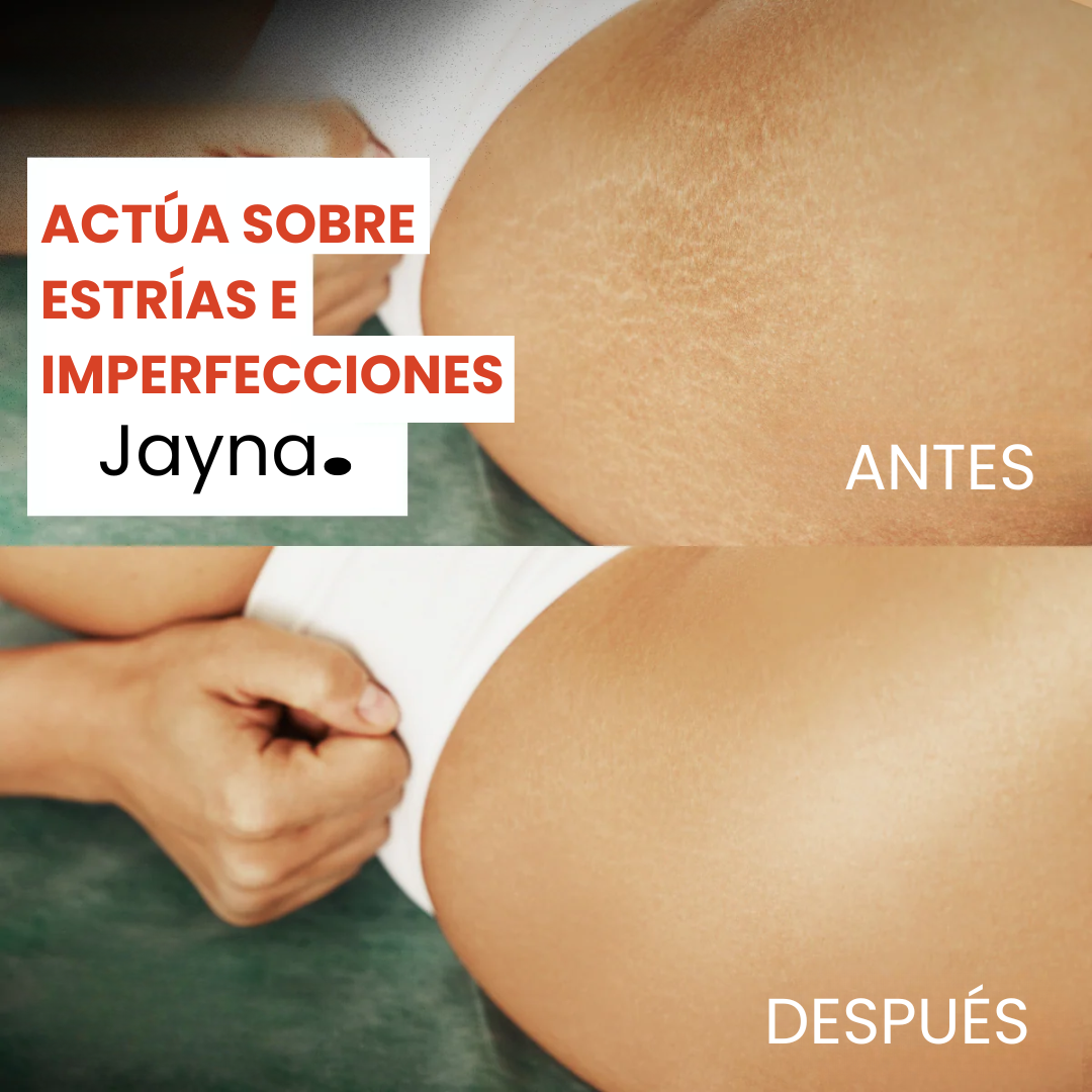 Jayna – Aceite corporal rejuvenecedor y reafirmante