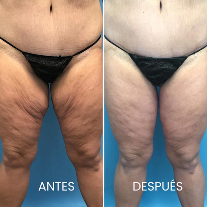 Jayna – Aceite corporal rejuvenecedor y reafirmante