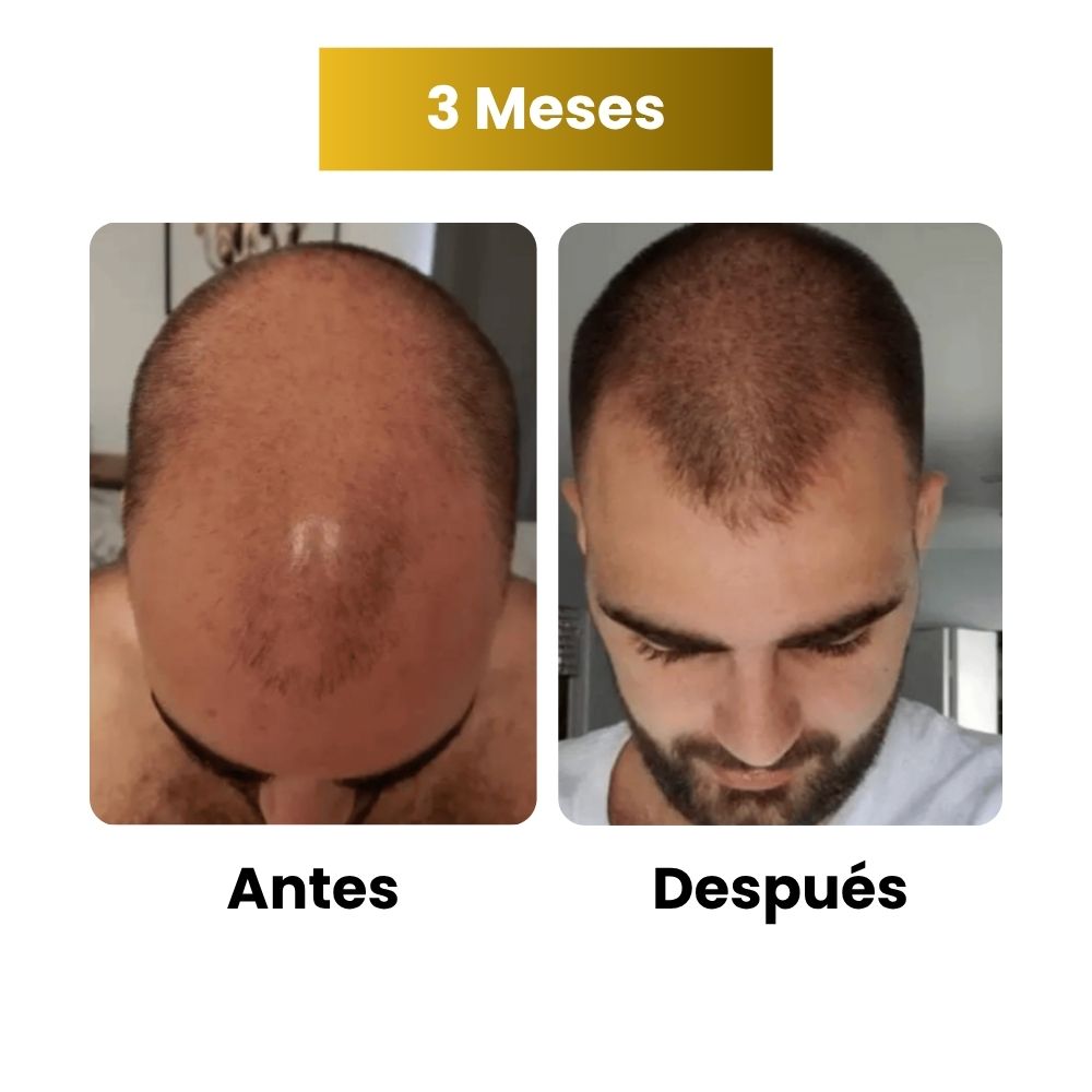 Sérum de crecimiento capilar para hombre (60 ml)