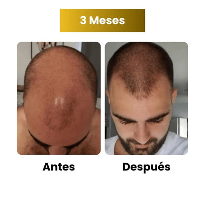 Sérum de crecimiento capilar para hombre (60 ml)