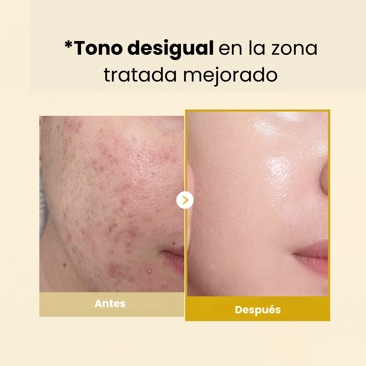 Despierta Con Una Piel Más Clara Con La MASCARILLA KÓJICO & CÚRCUMA