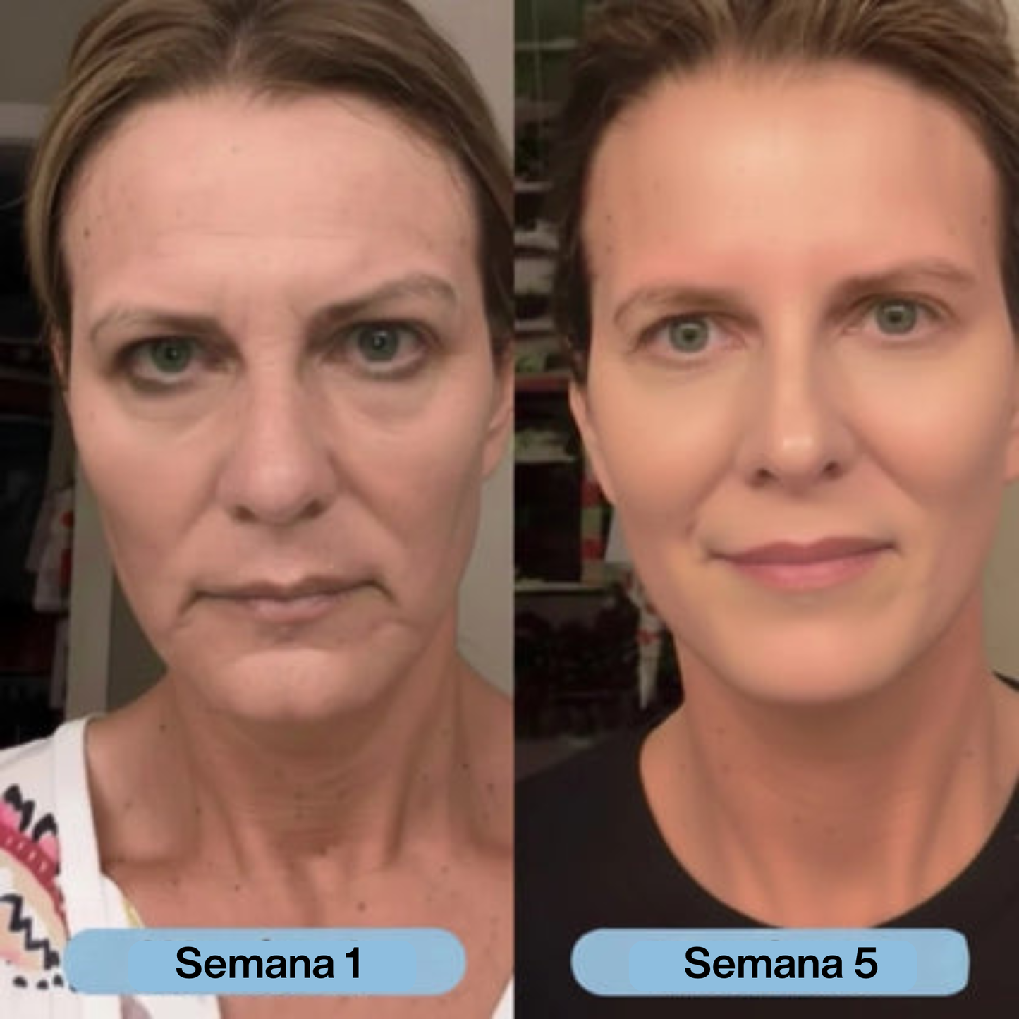 JaynaFina | Sérum de colágeno coreano para pieles maduraras