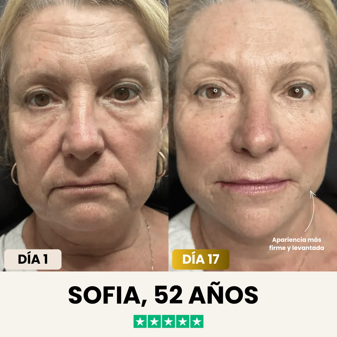 JaynaMask™ Lift - Despídete de tu papada ya