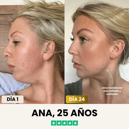 JaynaMask™ Lift - Despídete de tu papada ya